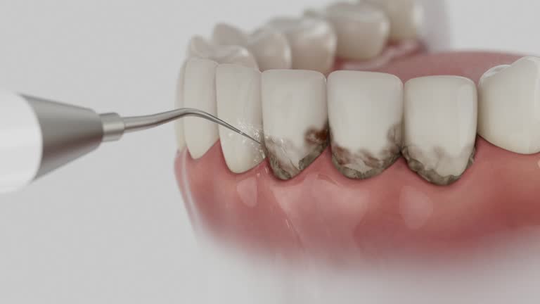 Reliable Dental Implants contractor in Shields, MI by Smile Center Dentistry